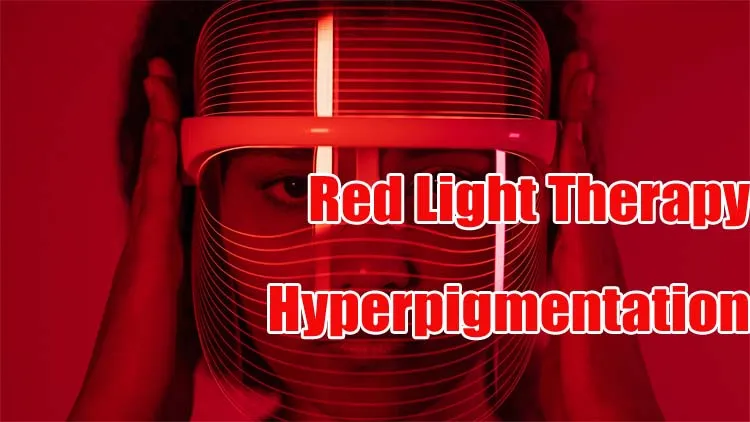 red light therapy for hyperpigmentation