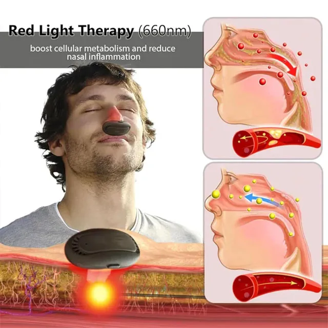 red light therapy for nasal polyps