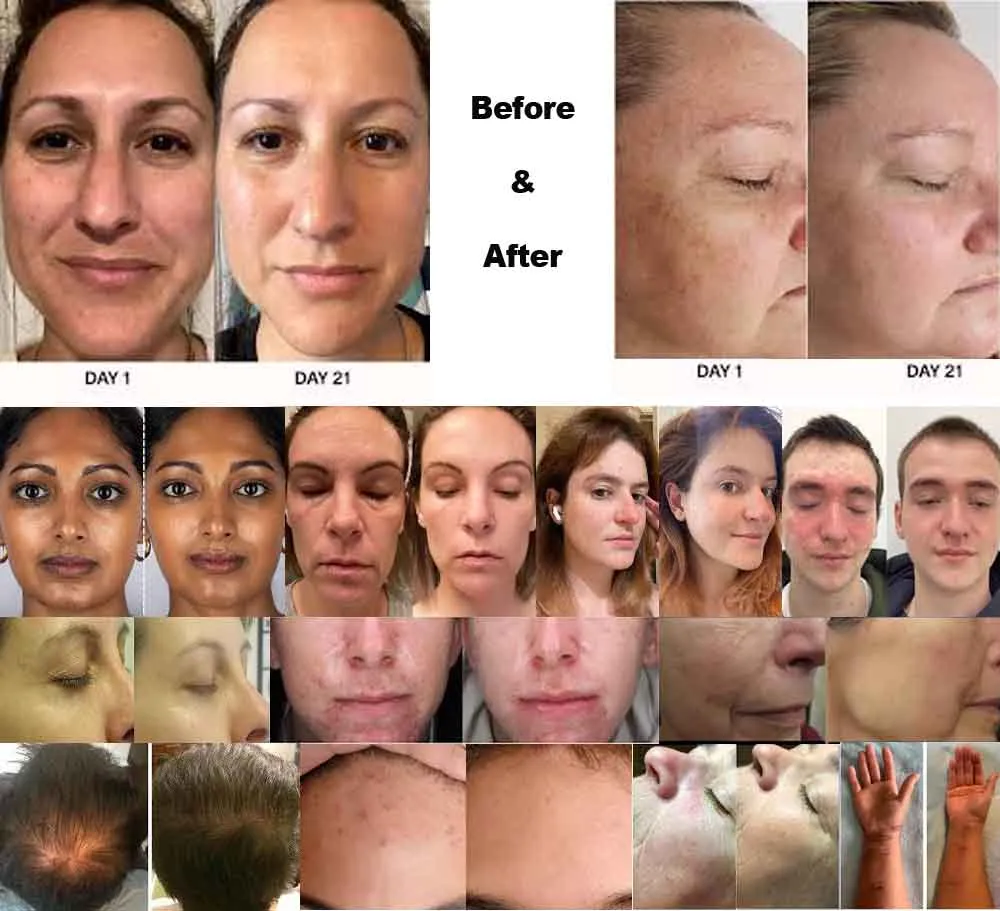 before and after