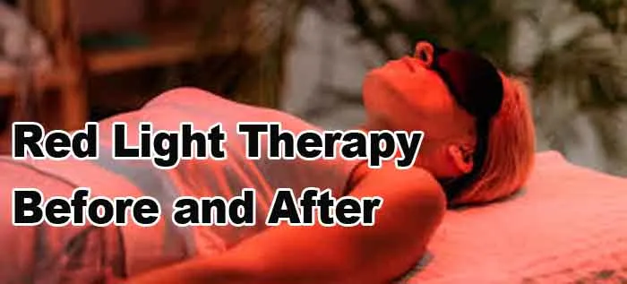red light therapy be and after comparison