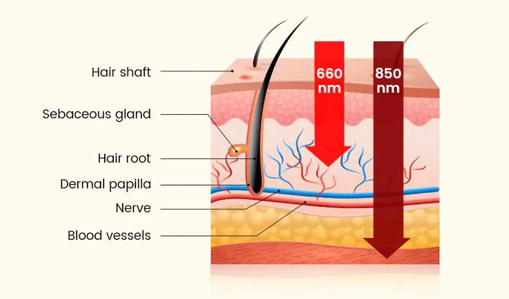 red light therapy for hair loss